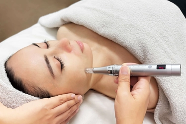 「エステ版ダーマペン」を手軽に導入！ サロン向け業務用美容機器『MISIRELTO SOFT DERMA』 2025年7月28日新発売！