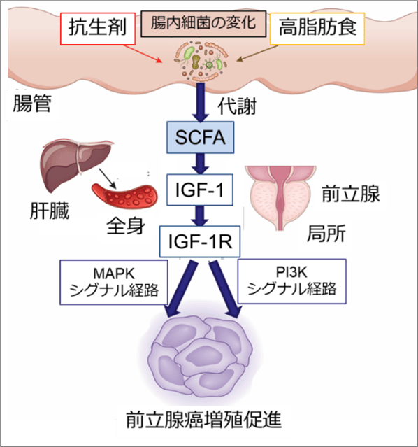 （図）前立腺がん増殖促進の仕組み