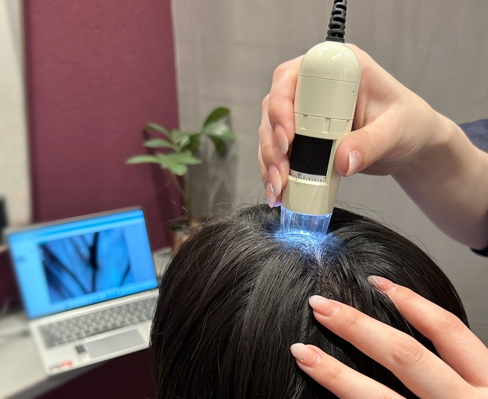 <ダヴィネス>頭皮チェック_無料体験会