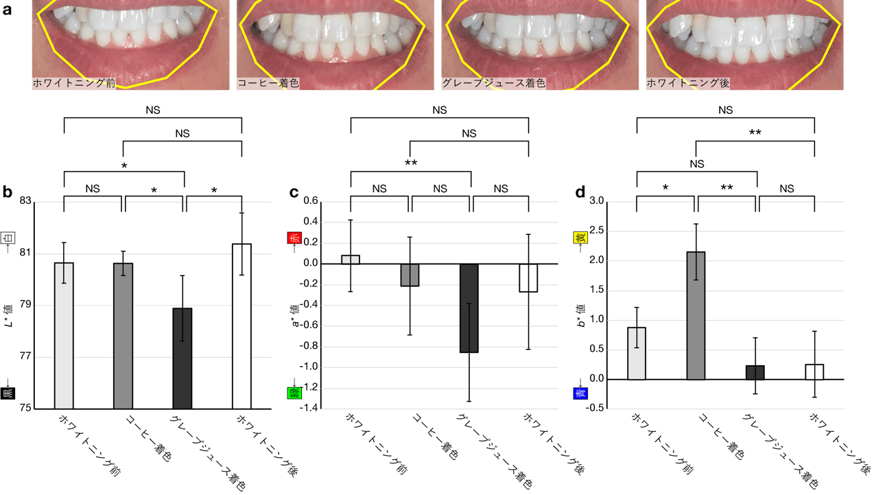 図1. アプリで撮影したホワイトニング前後の歯の画像(a)と色の変化(b-d)