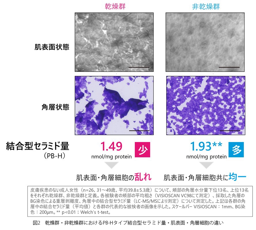 図2 乾燥群・非乾燥群におけるPB-Hタイプ結合型セラミド量・肌表面・角層細胞の違い