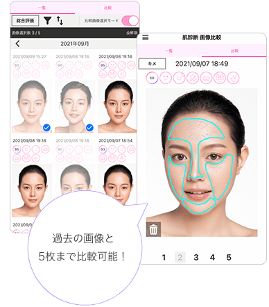 画像比較機能イメージ