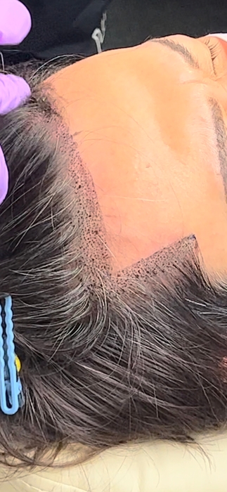 スカルプイメージです!生え際が気になる方も!