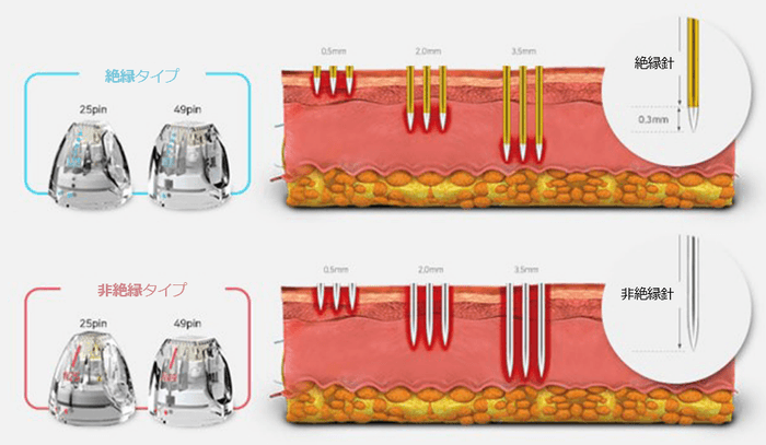 絶縁針と非絶縁針