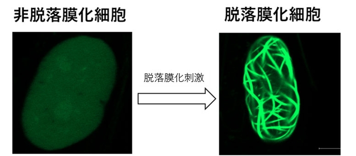 図1:脱落膜化における核内アクチン集合体形成 アクチンをGFPタンパクで標識することで、核内アクチンを可視化できる子宮内膜間質細胞を樹立した。この細胞に脱落膜化刺激を加え脱落膜化を誘導したところ、線状のGFP構造(アクチン凝集体)が出現した。