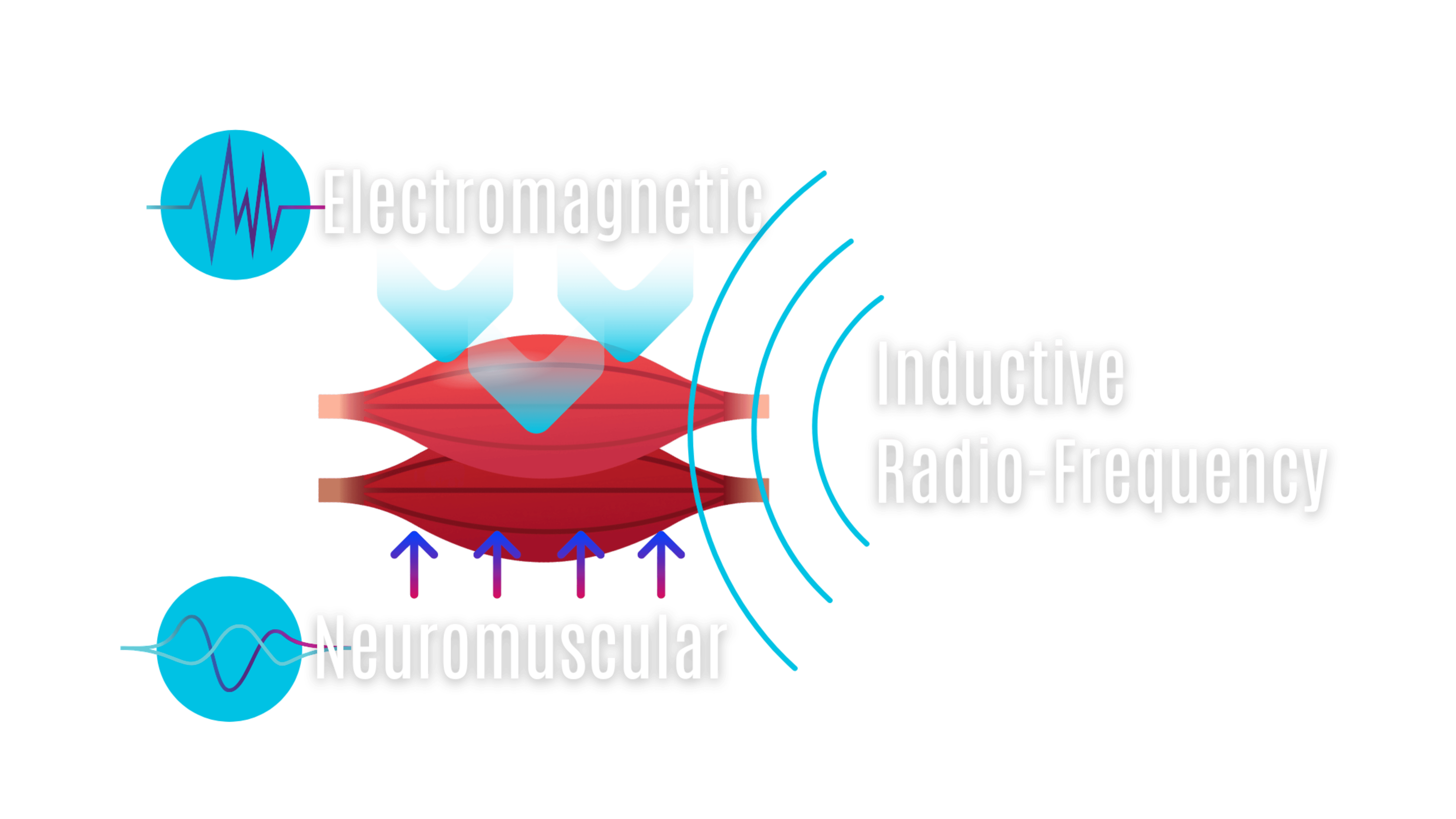 3Dニューロウェーブ