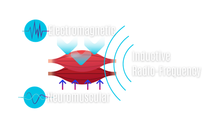 3Dニューロウェーブ